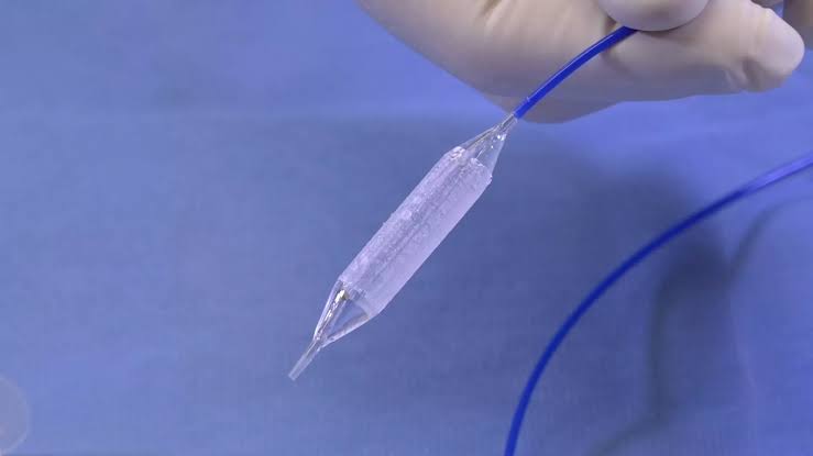 Ureteroscopic lithotripsy URSL